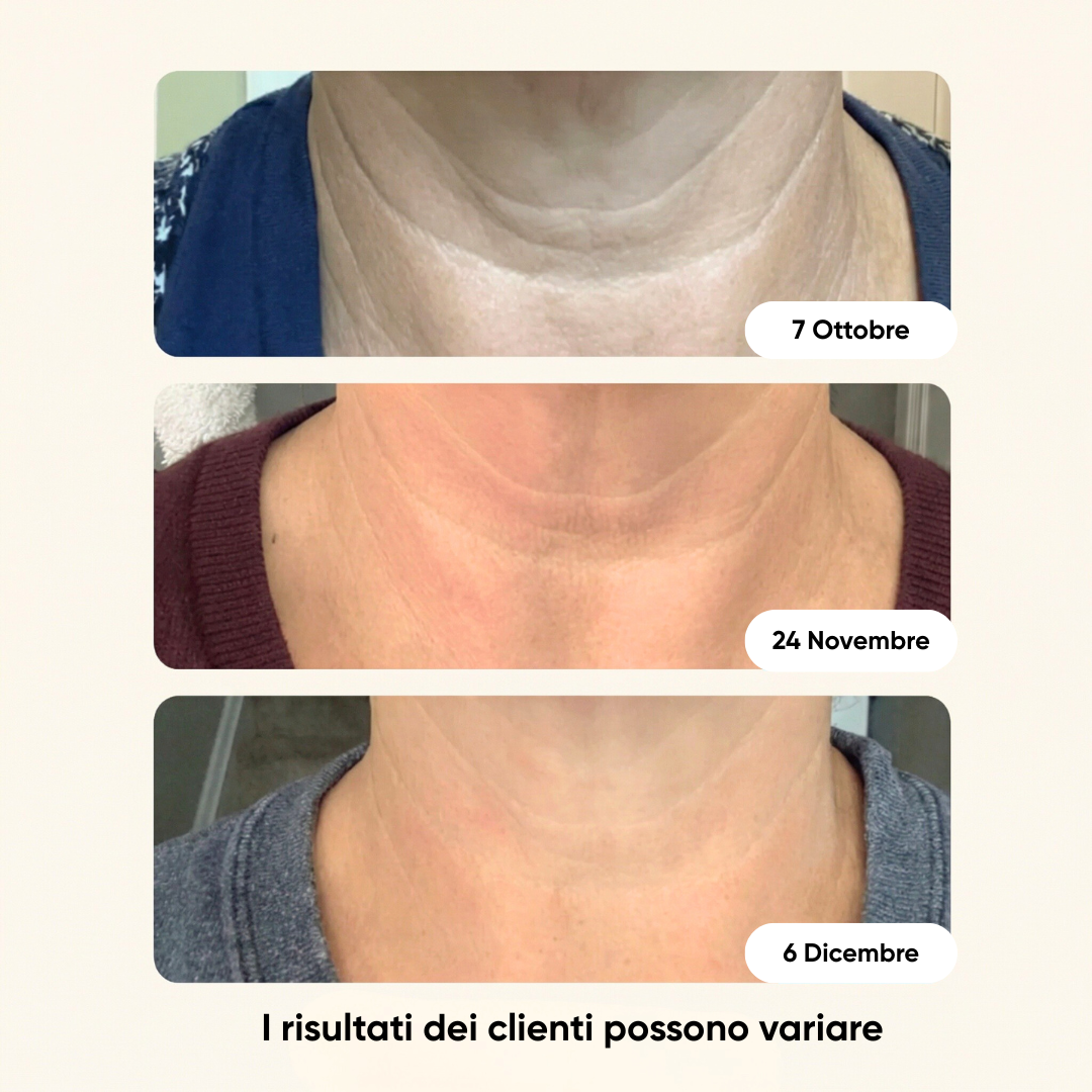 Non nasconderlo. Il segreto per un collo che sembra 10 anni più giovane senza chirurgia