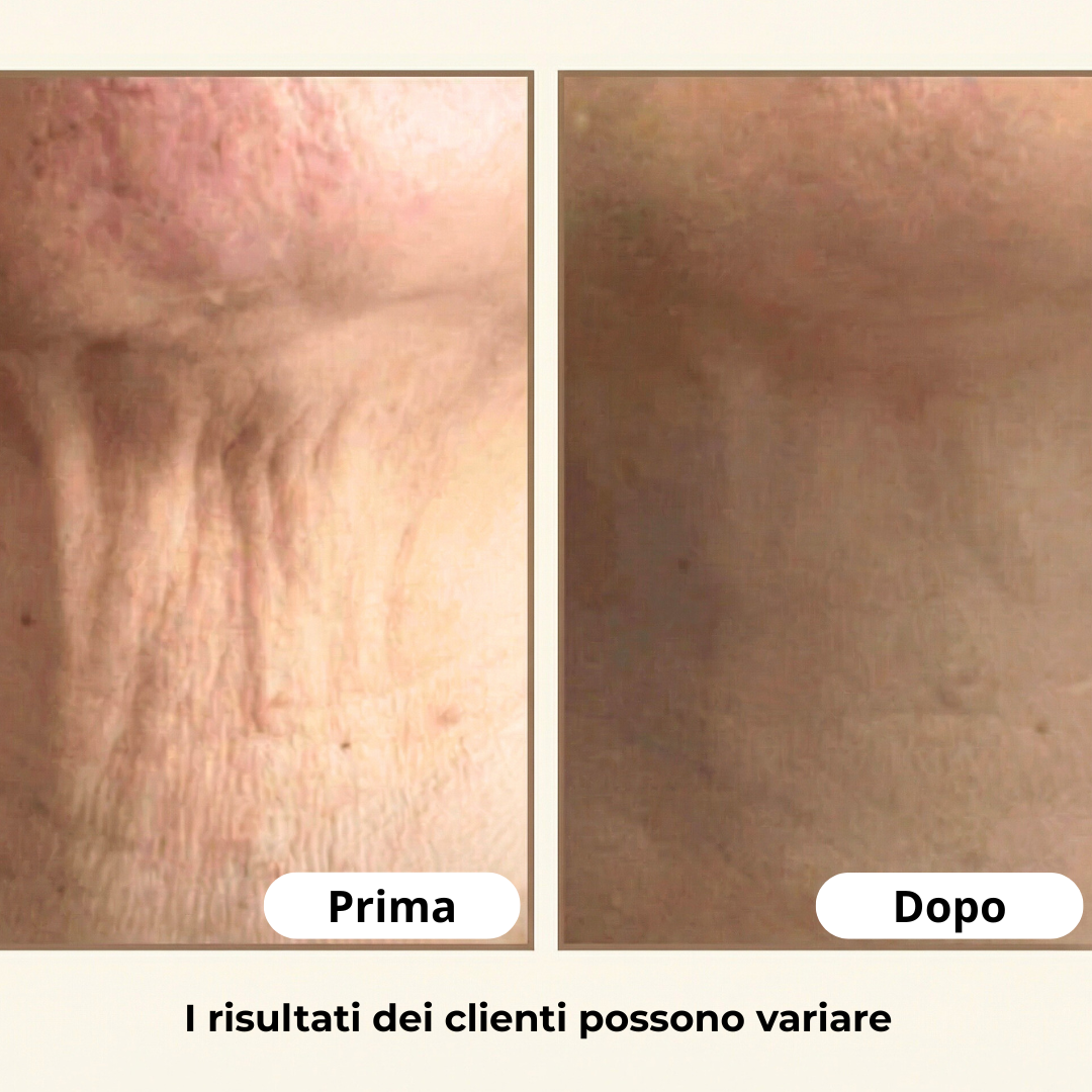 Non nasconderlo. Il segreto per un collo che sembra 10 anni più giovane senza chirurgia