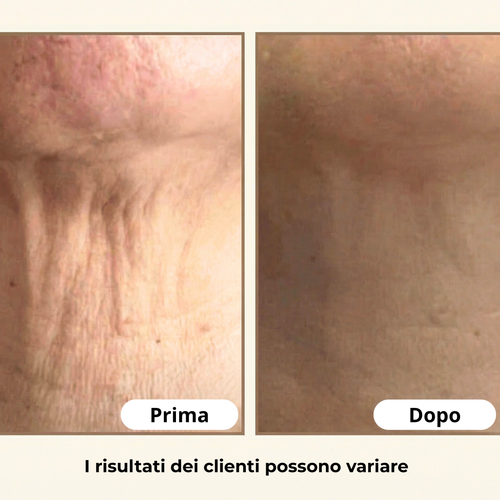 Non nasconderlo. Il segreto per un collo che sembra 10 anni più giovane senza chirurgia